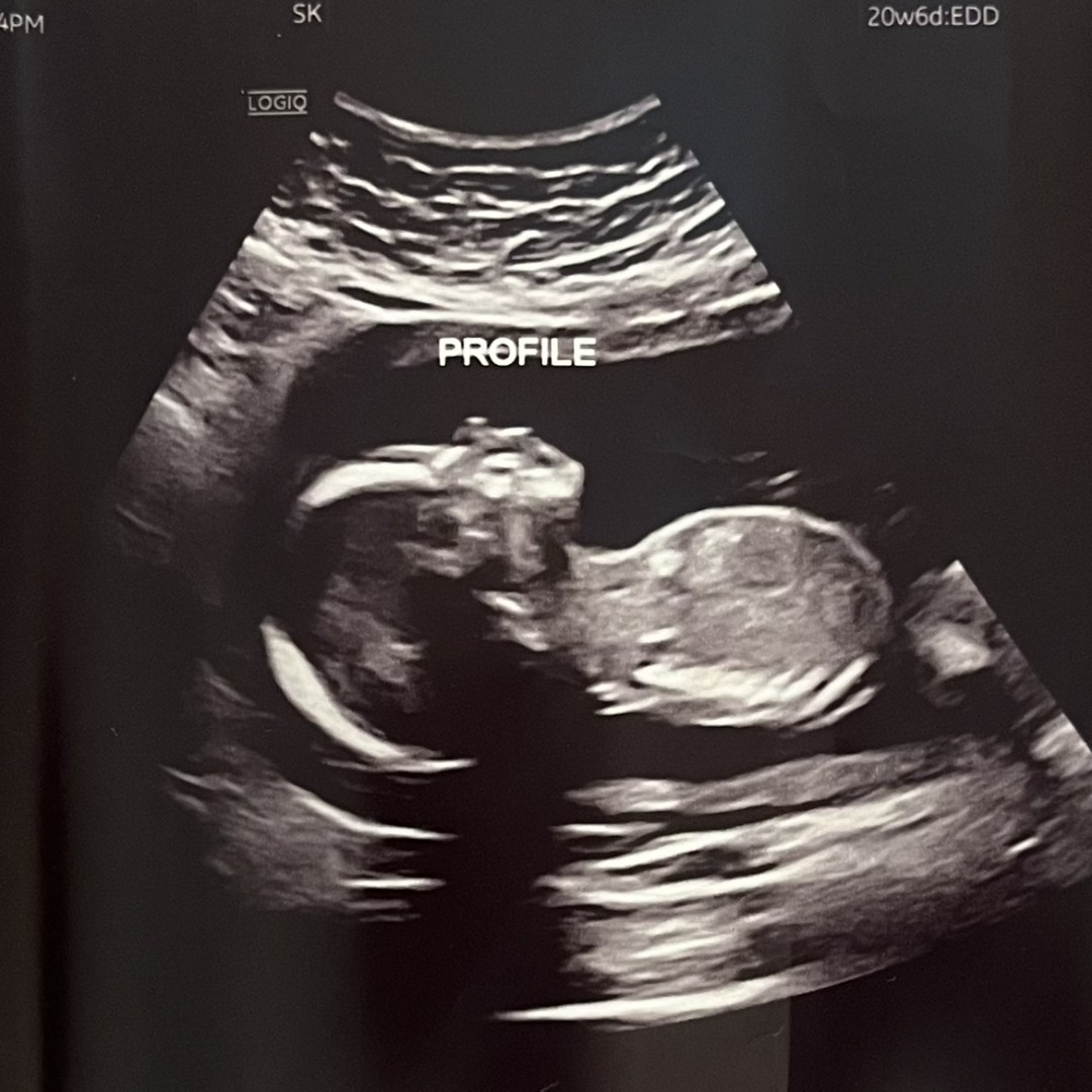 Photo shared by Baleigh for their Babylist baby registry.