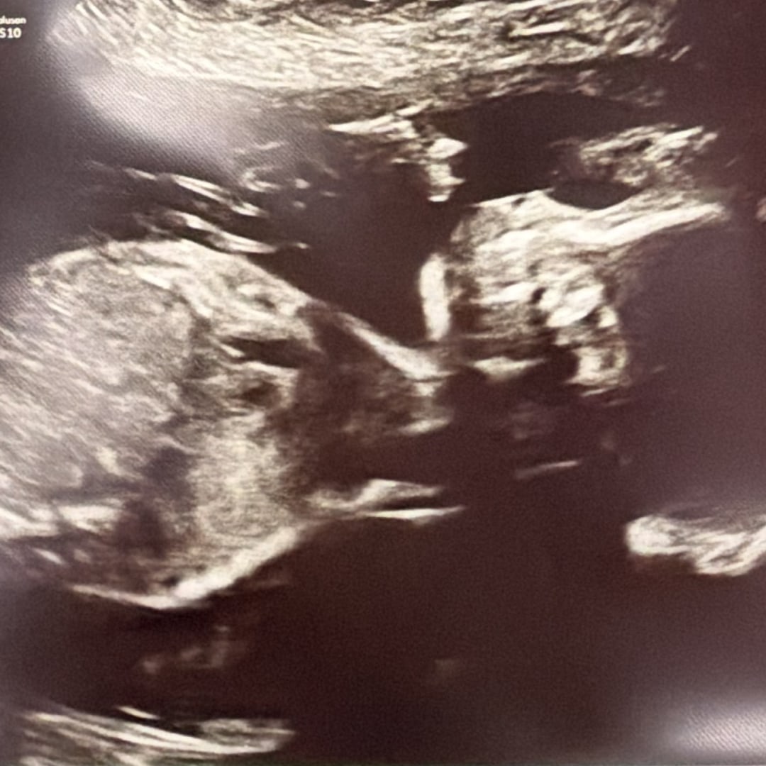 Photo shared by Clair for their Babylist baby registry.
