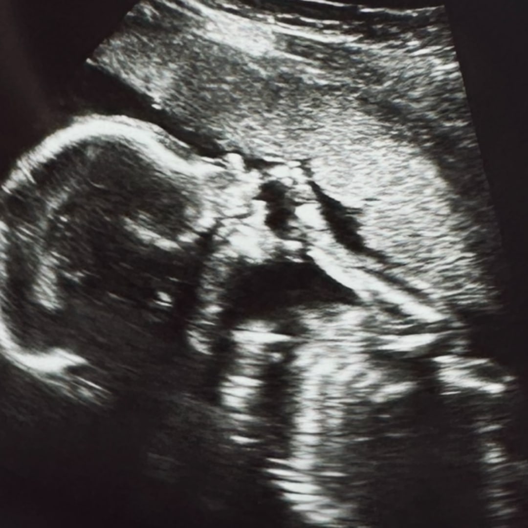Photo shared by Angela for their Babylist baby registry.