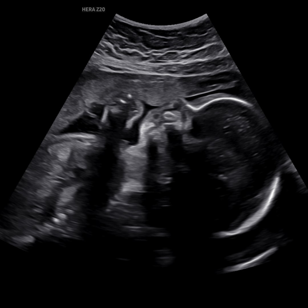 Photo shared by Destiny for their Babylist baby registry.