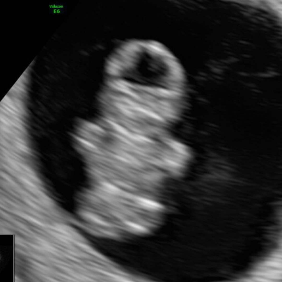 Photo shared by Allie for their Babylist baby registry.