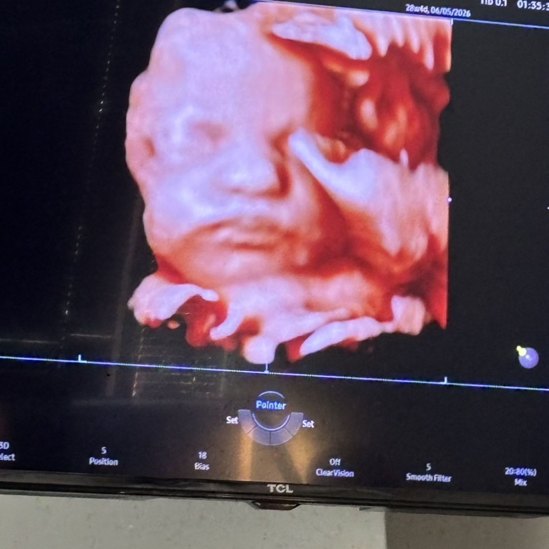 Photo shared by Bella for their Babylist baby registry.