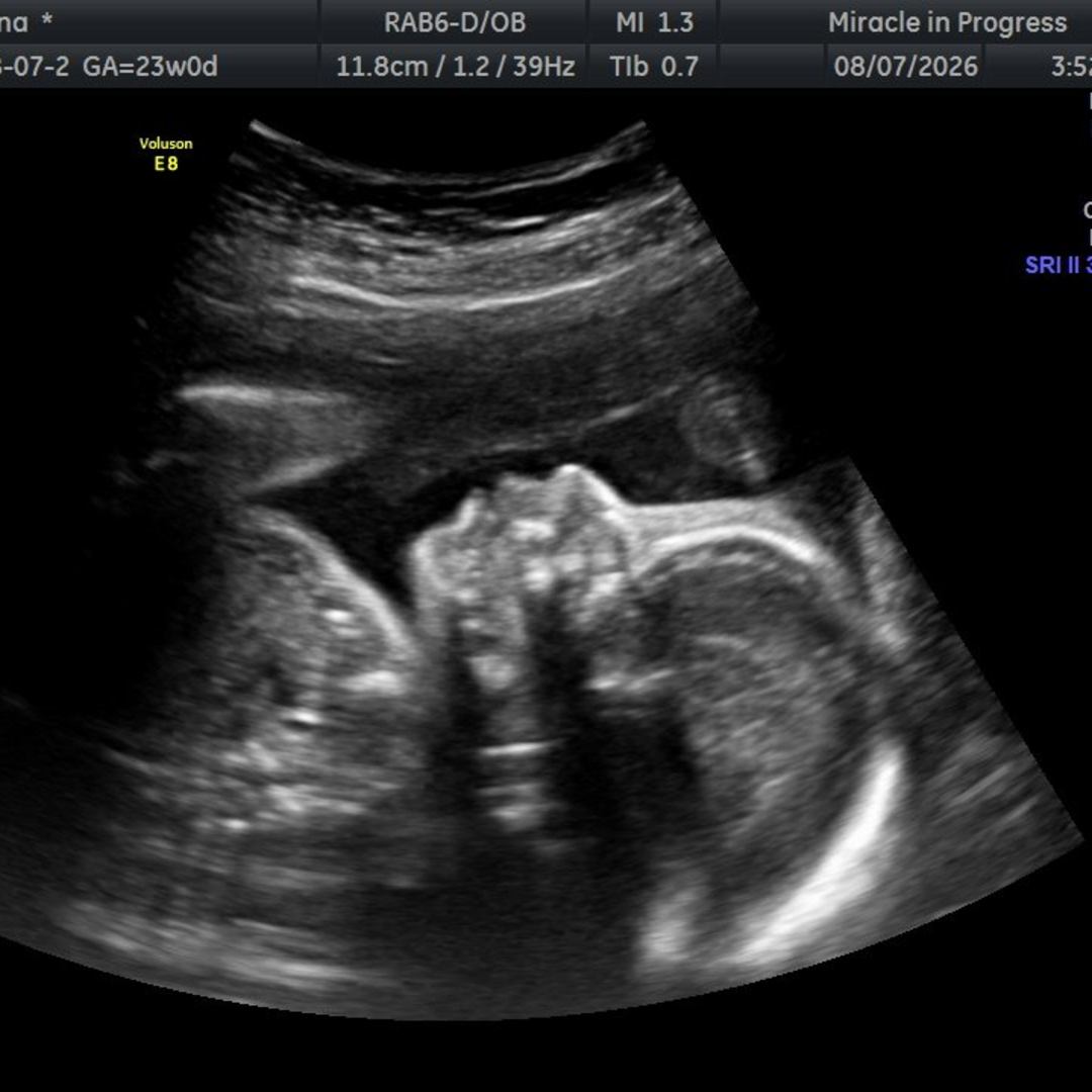 Photo shared by Arianna for their Babylist baby registry.