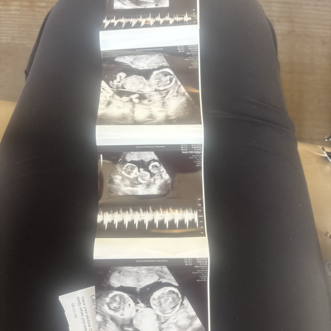 Photo shared by Nyla for their Babylist baby registry.