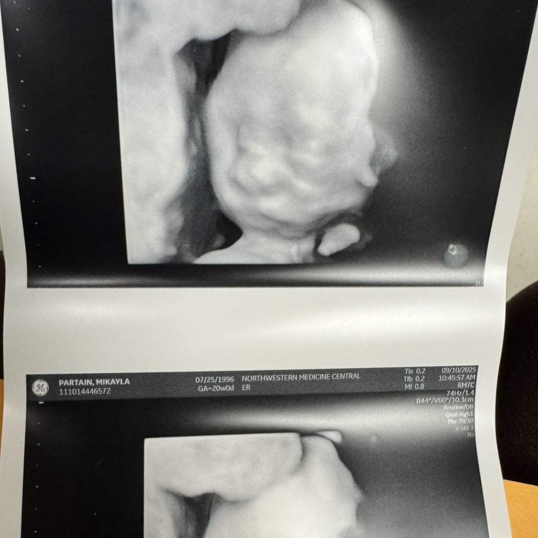 Photo shared by Mikayla for their Babylist baby registry.