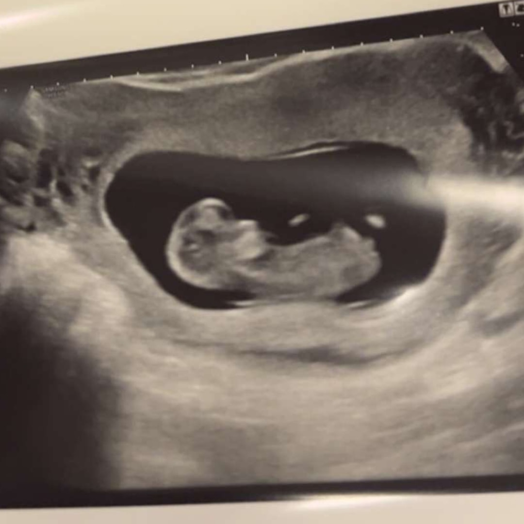 Photo shared by Elsie for their Babylist baby registry.