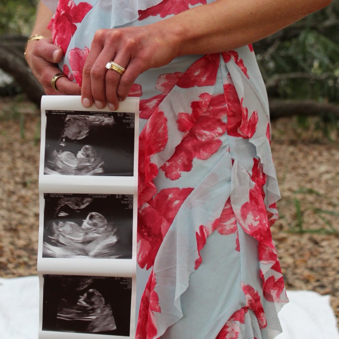 Photo shared by Mariah for their Babylist baby registry.