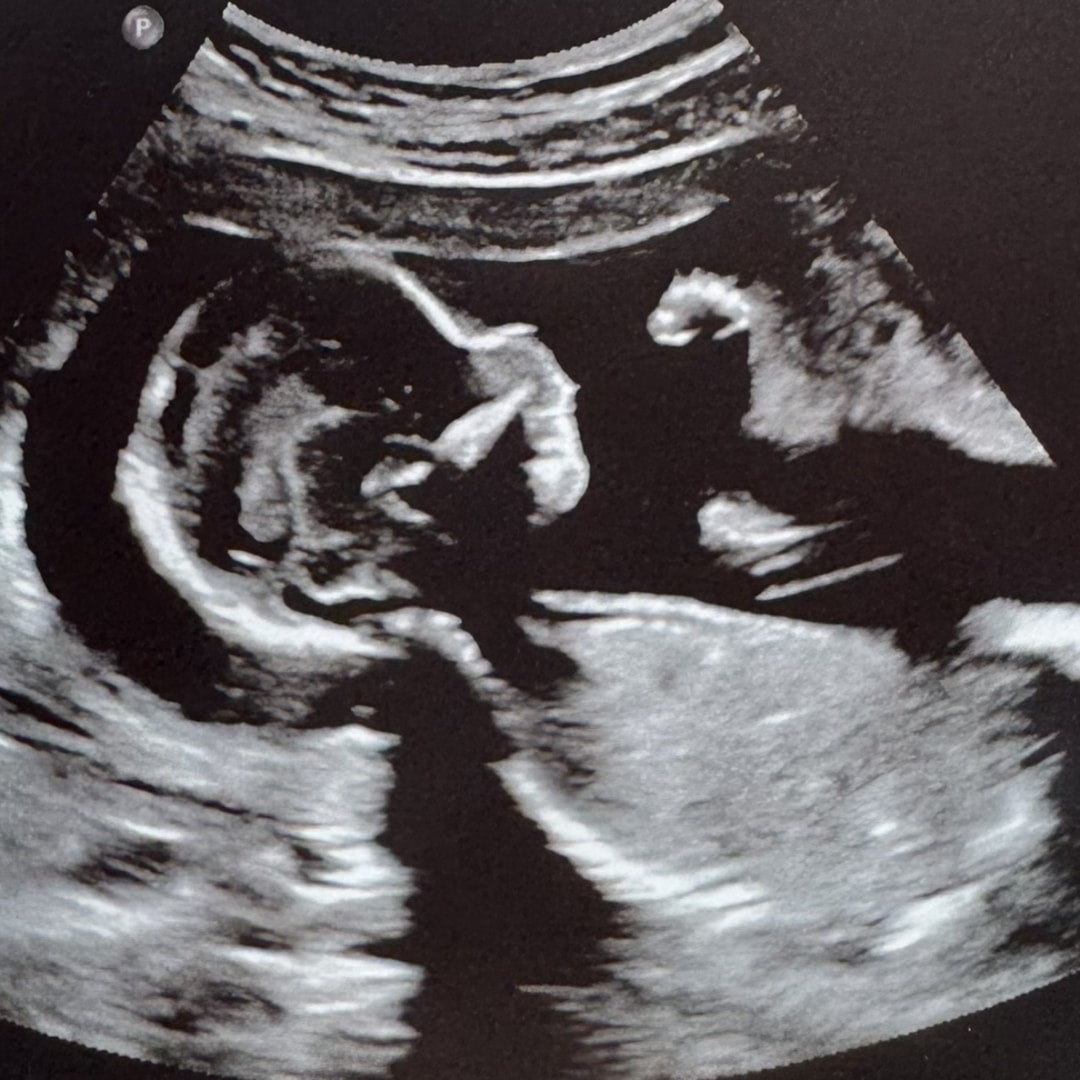 Photo shared by Megan for their Babylist baby registry.