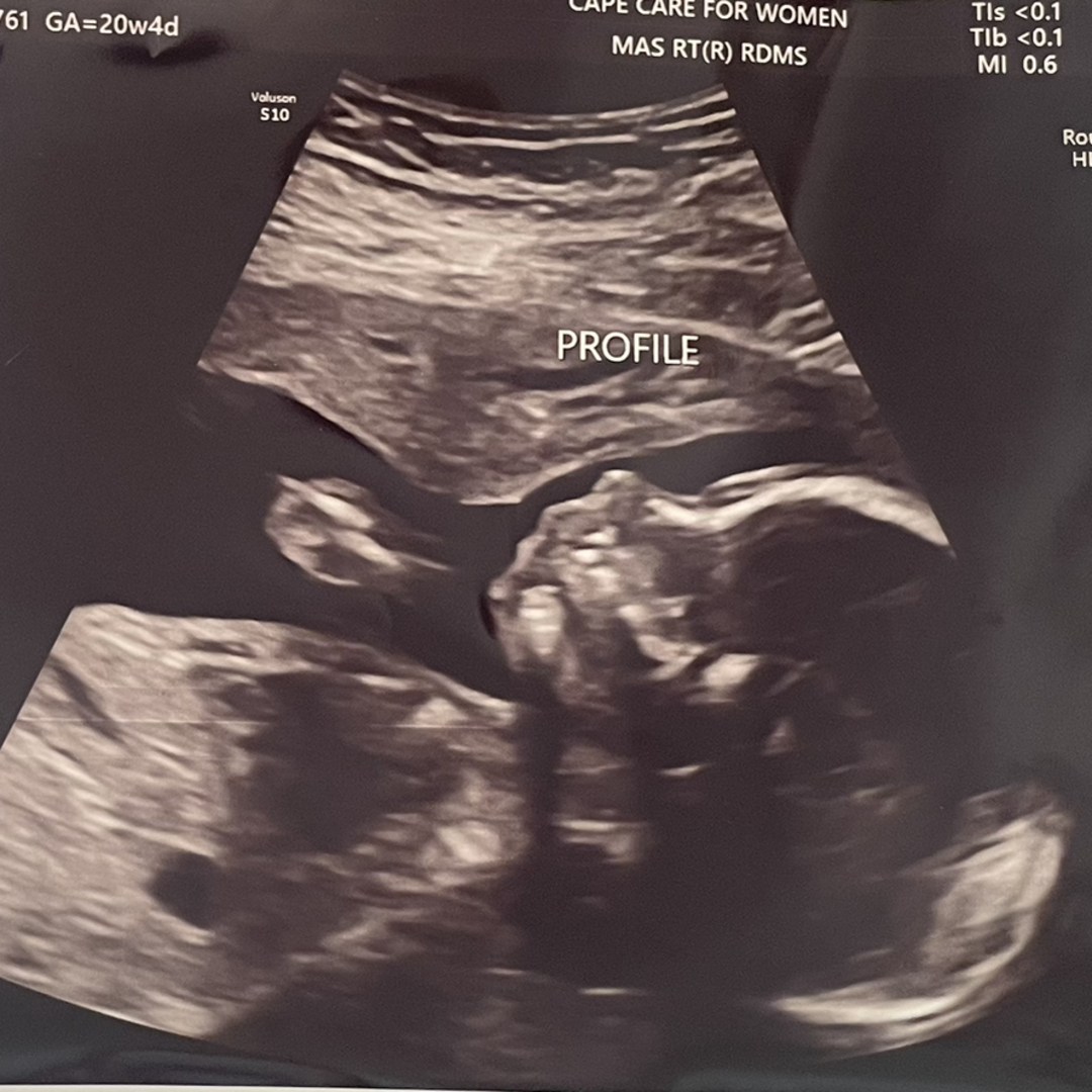 Photo shared by Grace for their Babylist baby registry.