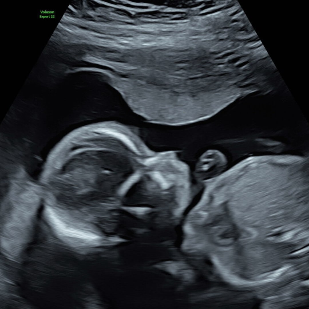 Photo shared by Morgan for their Babylist baby registry.