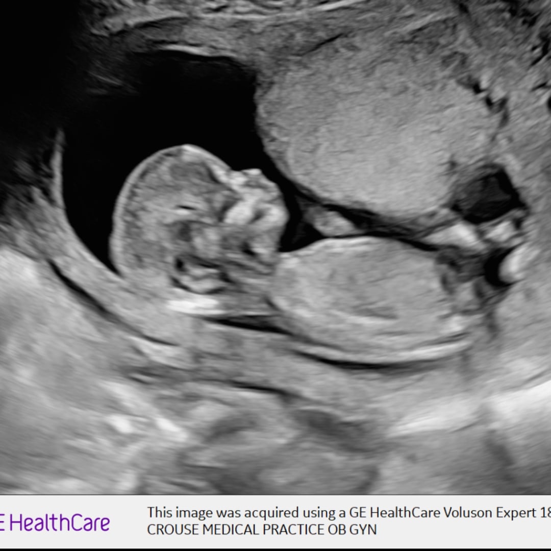Photo shared by Alissa for their Babylist baby registry.