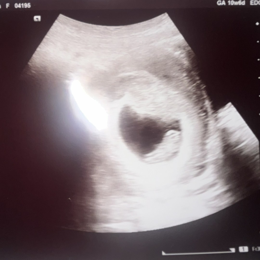 Photo shared by Emily for their Babylist baby registry.