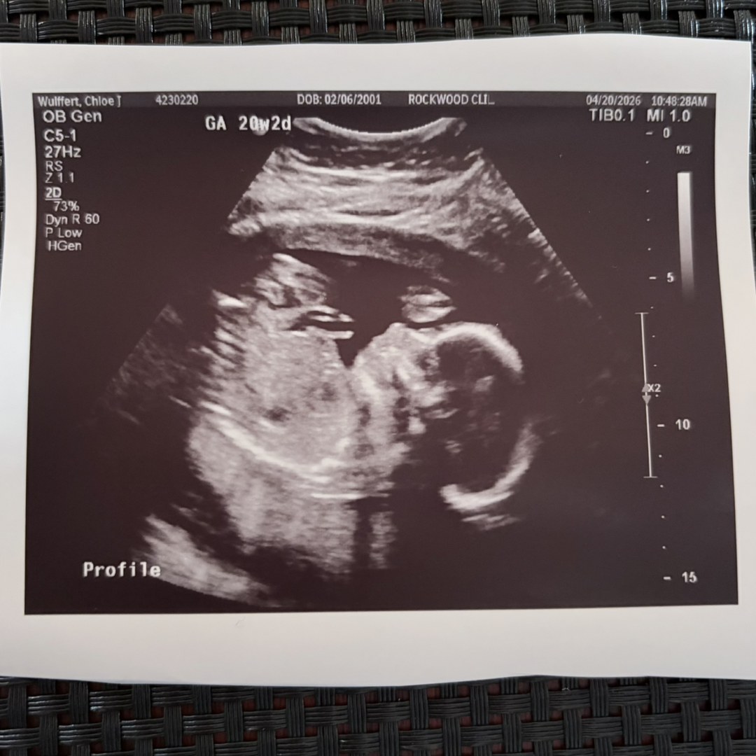 Photo shared by Chloe for their Babylist baby registry.
