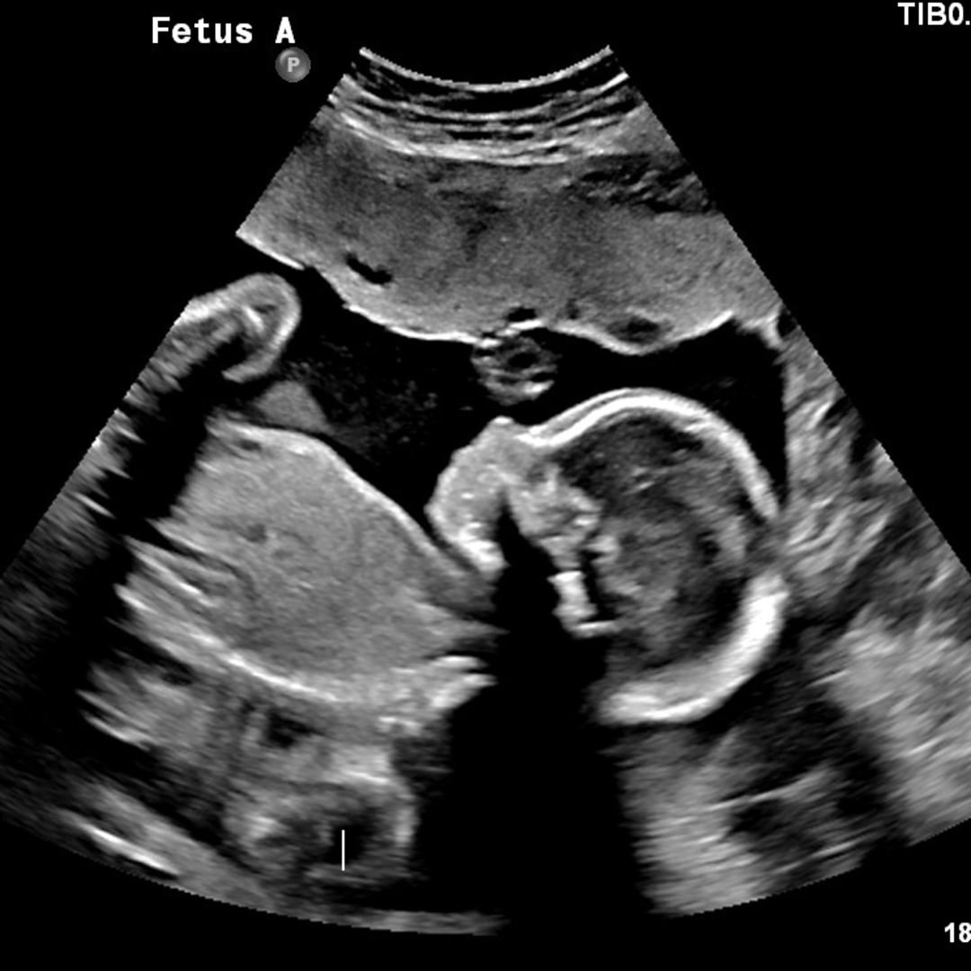 Photo shared by Jordan for their Babylist baby registry.