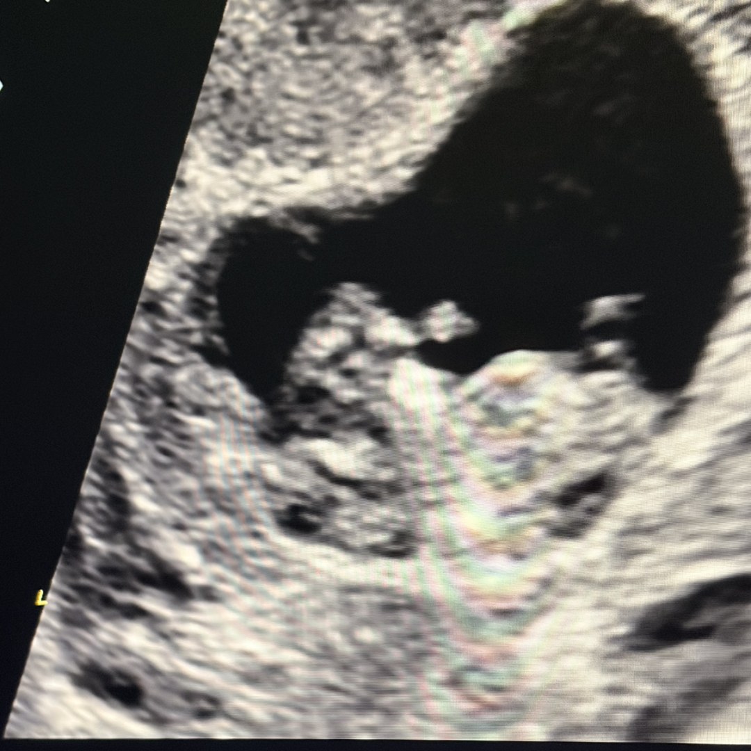 Photo shared by Dava for their Babylist baby registry.