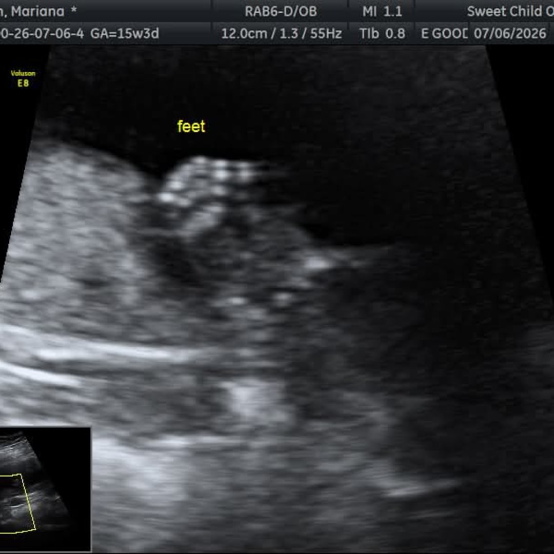 Photo shared by Mariana for their Babylist baby registry.