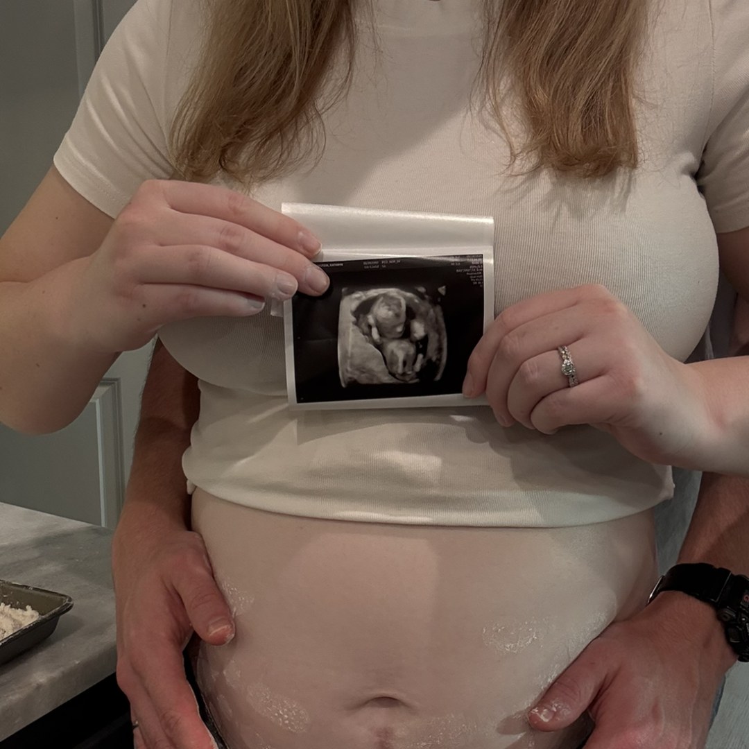 Photo shared by Katie for their Babylist baby registry.