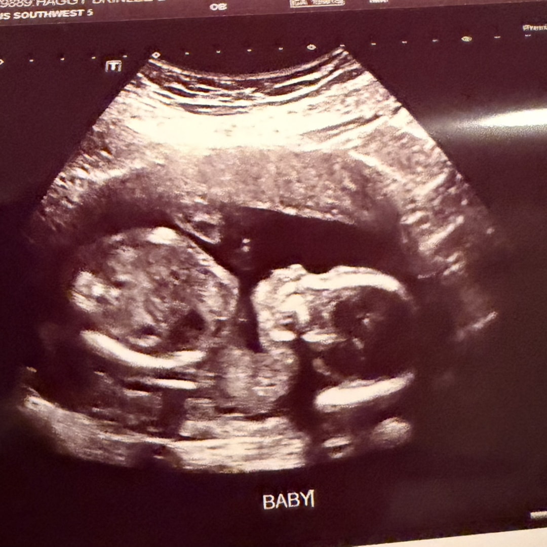 Photo shared by Brinlee for their Babylist baby registry.
