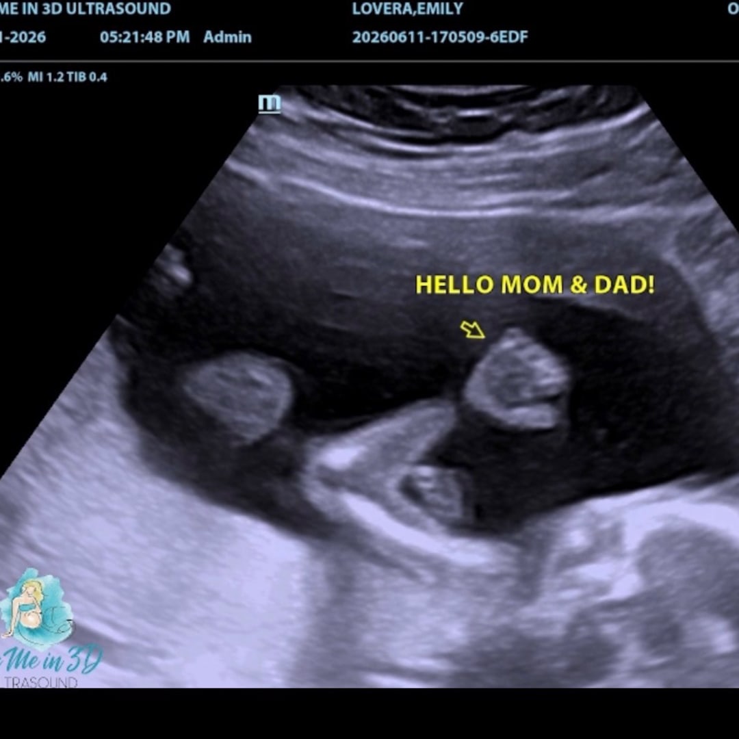 Photo shared by Emilie for their Babylist baby registry.
