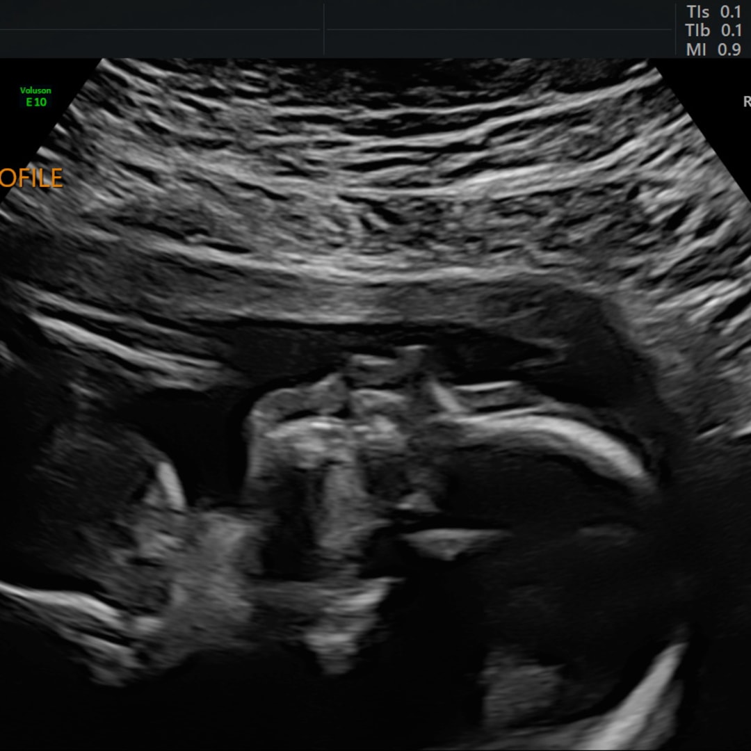 Photo shared by Megan for their Babylist baby registry.