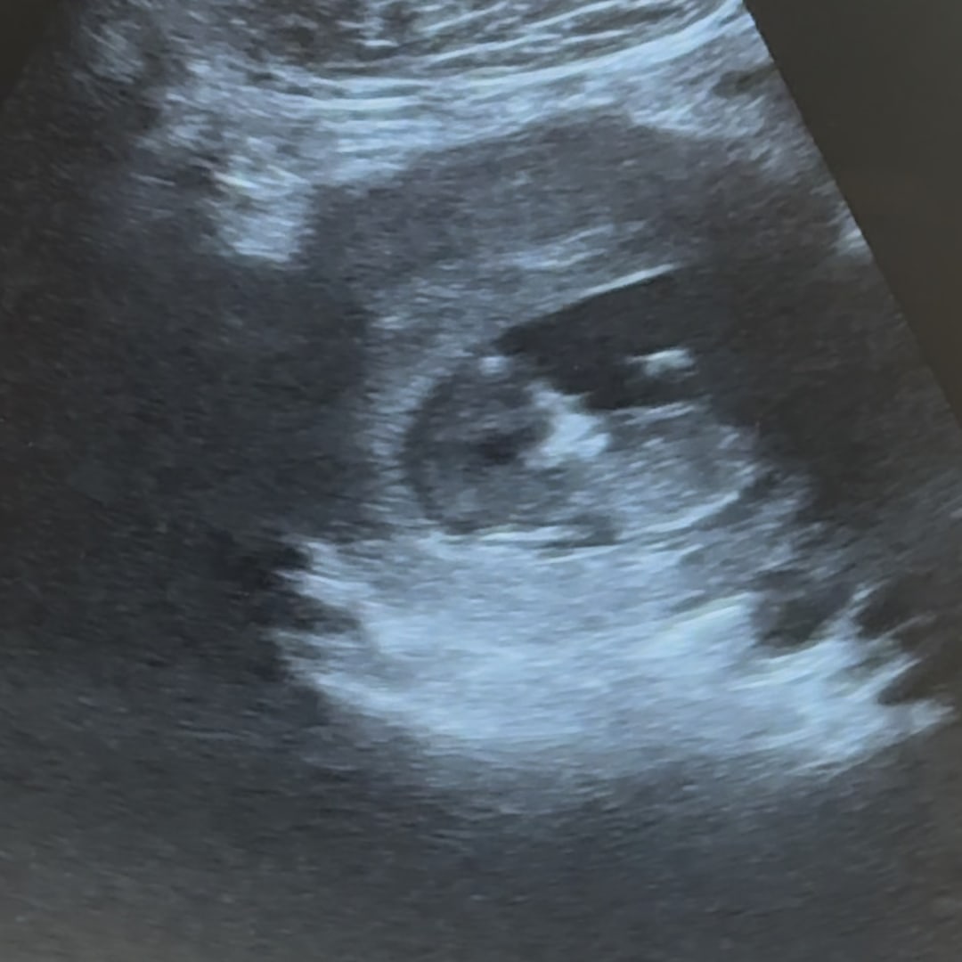 Photo shared by Kerterial for their Babylist baby registry.