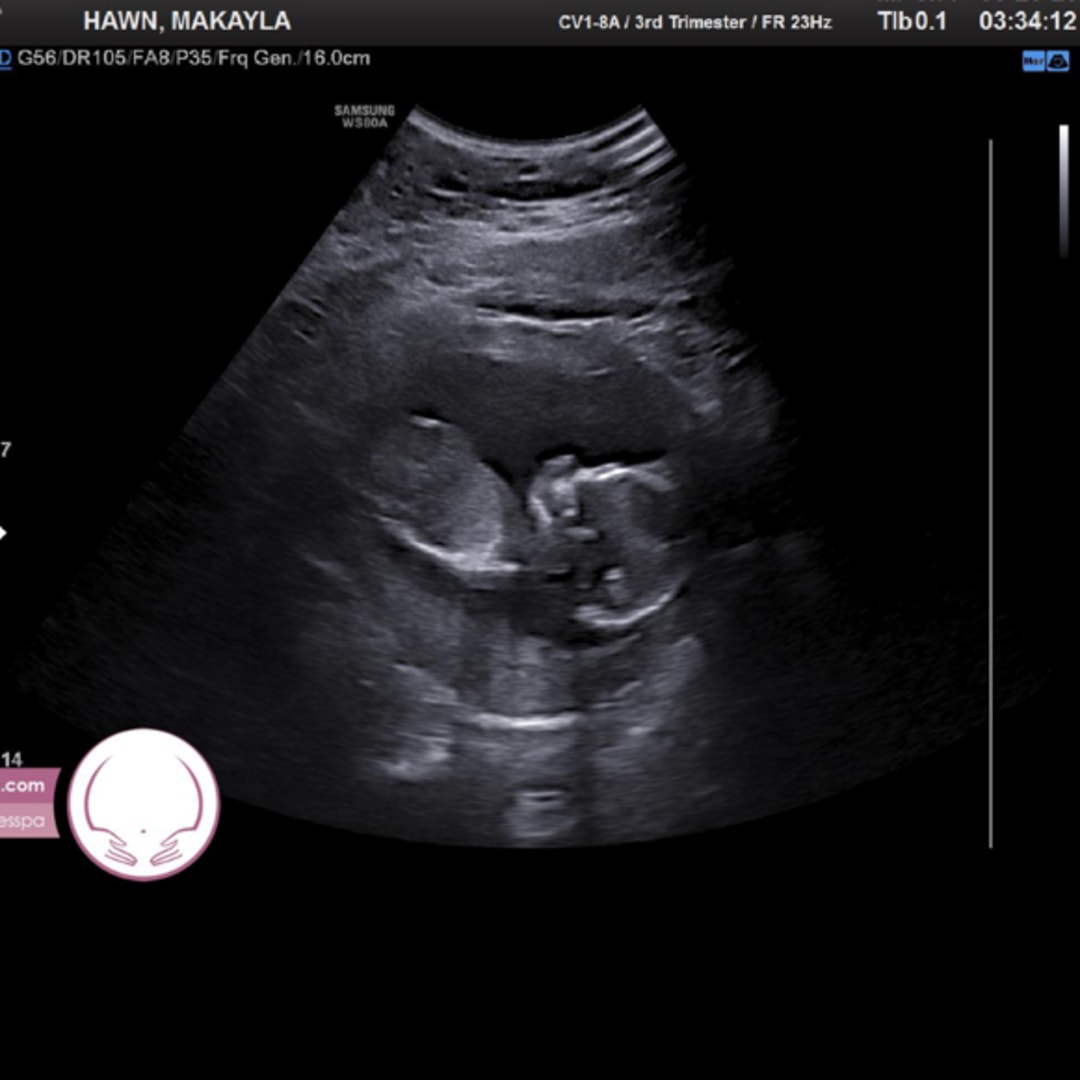 Photo shared by Makayla for their Babylist baby registry.