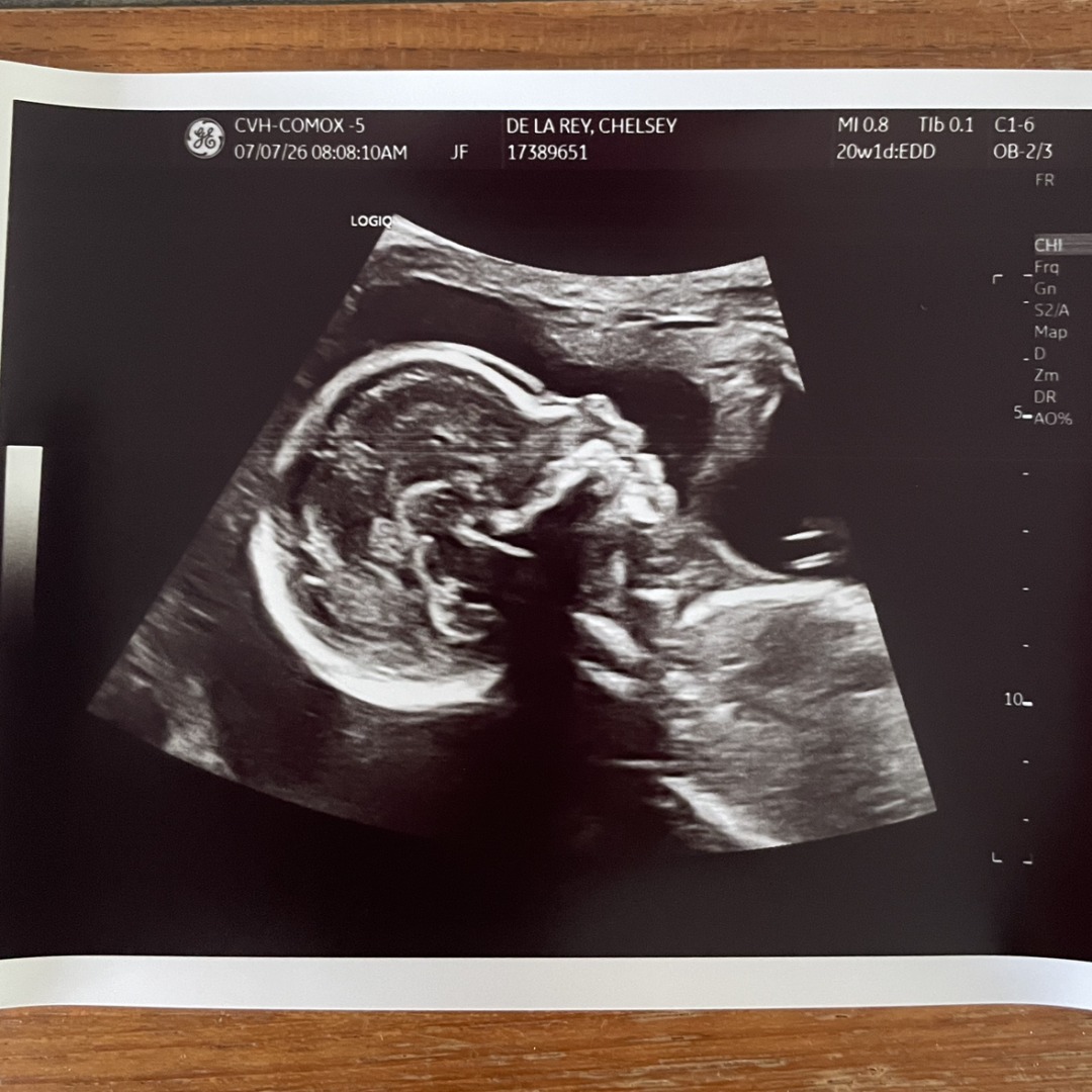 Photo shared by Chelsey for their Babylist baby registry.
