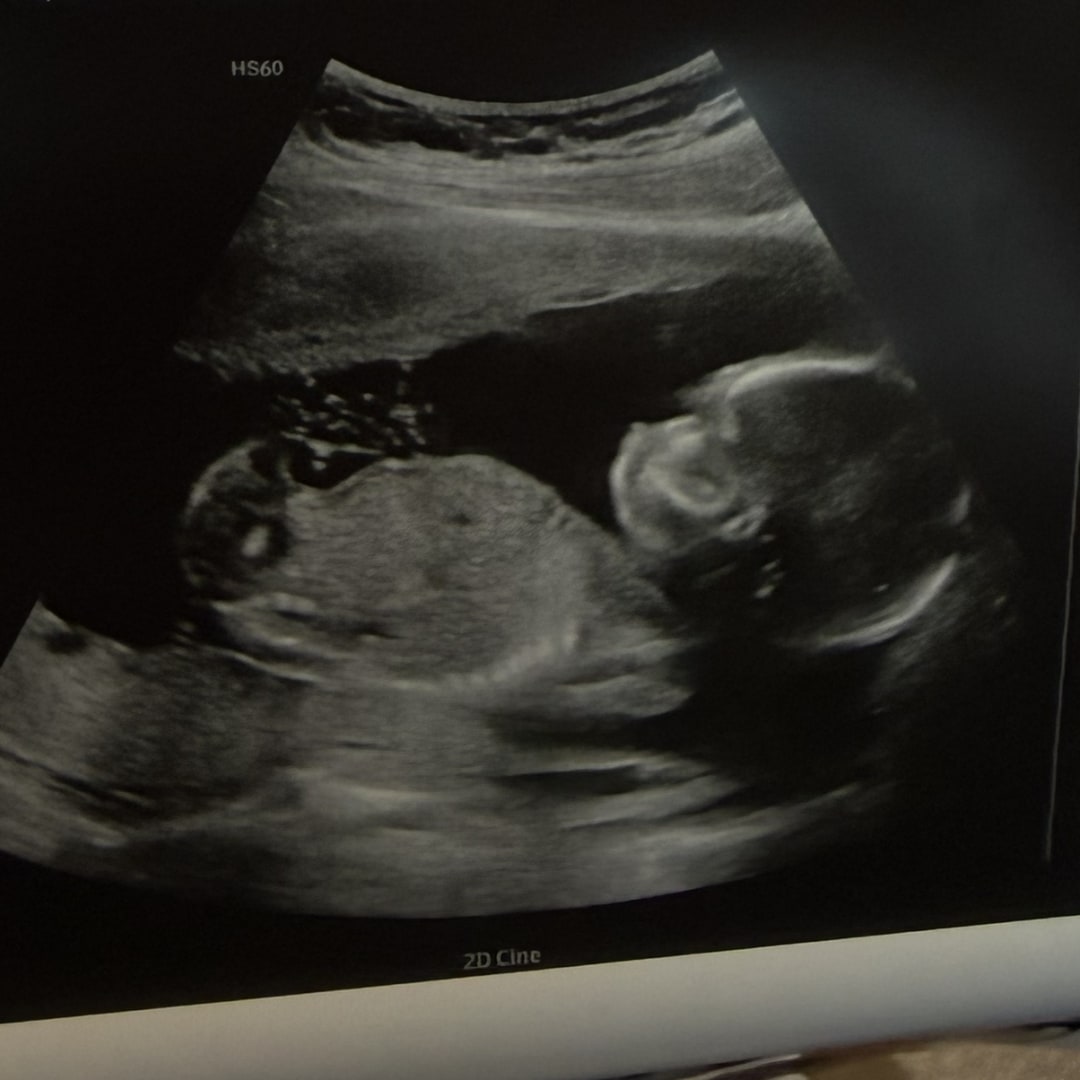 Photo shared by Allie for their Babylist baby registry.