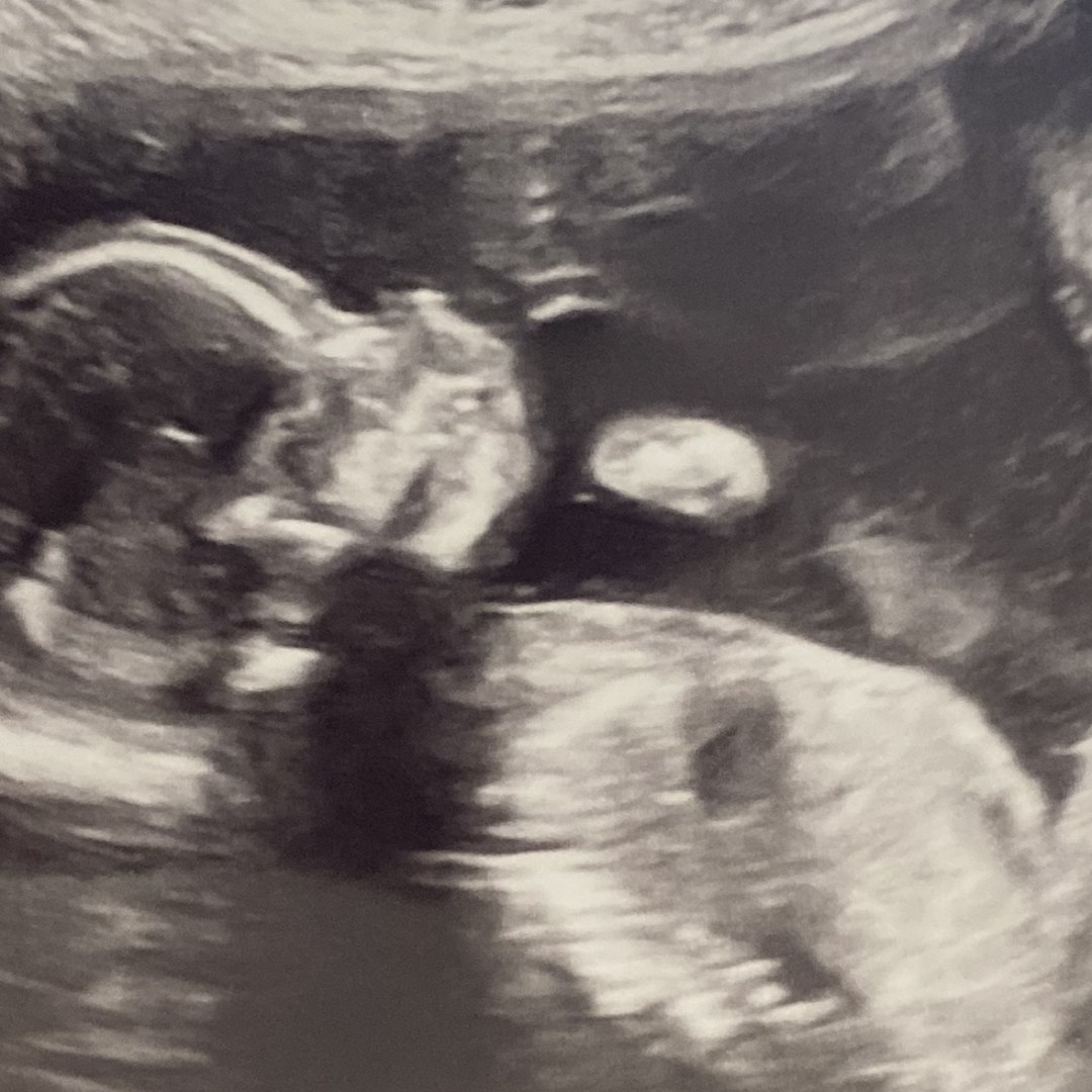 Photo shared by Maddie for their Babylist baby registry.