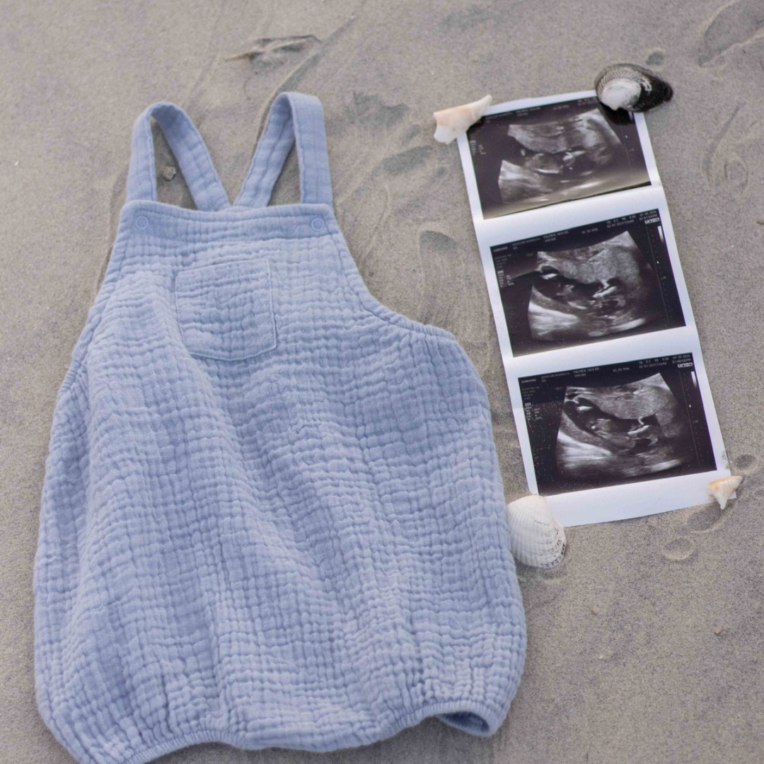 Photo shared by Skylar for their Babylist baby registry.