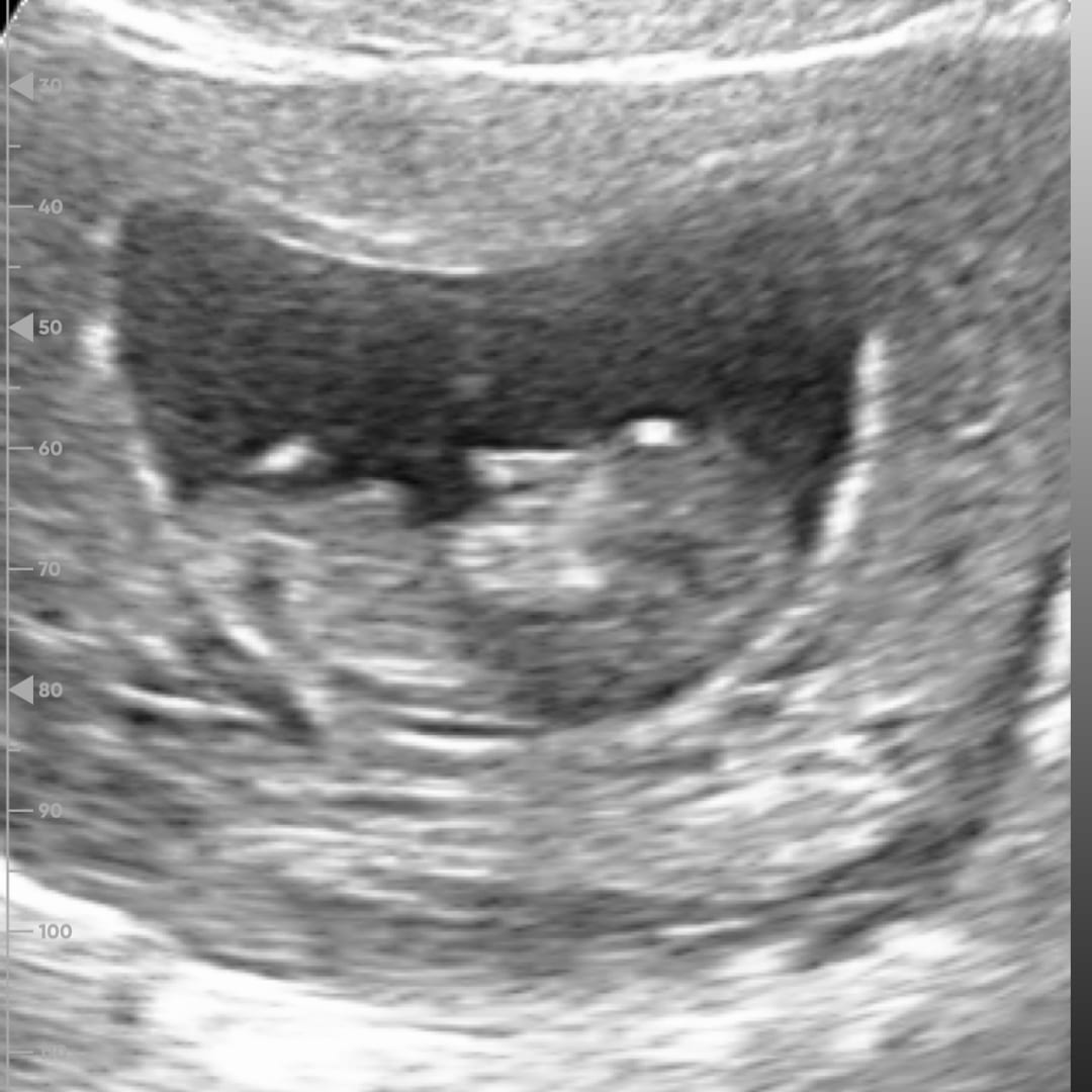 Photo shared by Kayla for their Babylist baby registry.