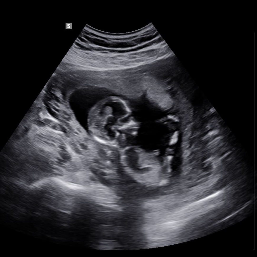 Photo shared by Jaycee for their Babylist baby registry.