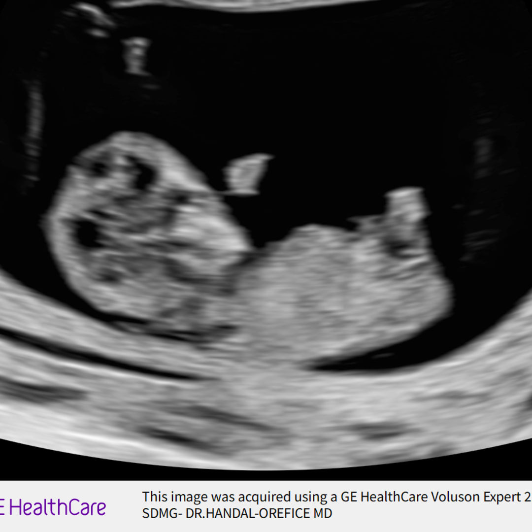 Photo shared by Chelsea for their Babylist baby registry.