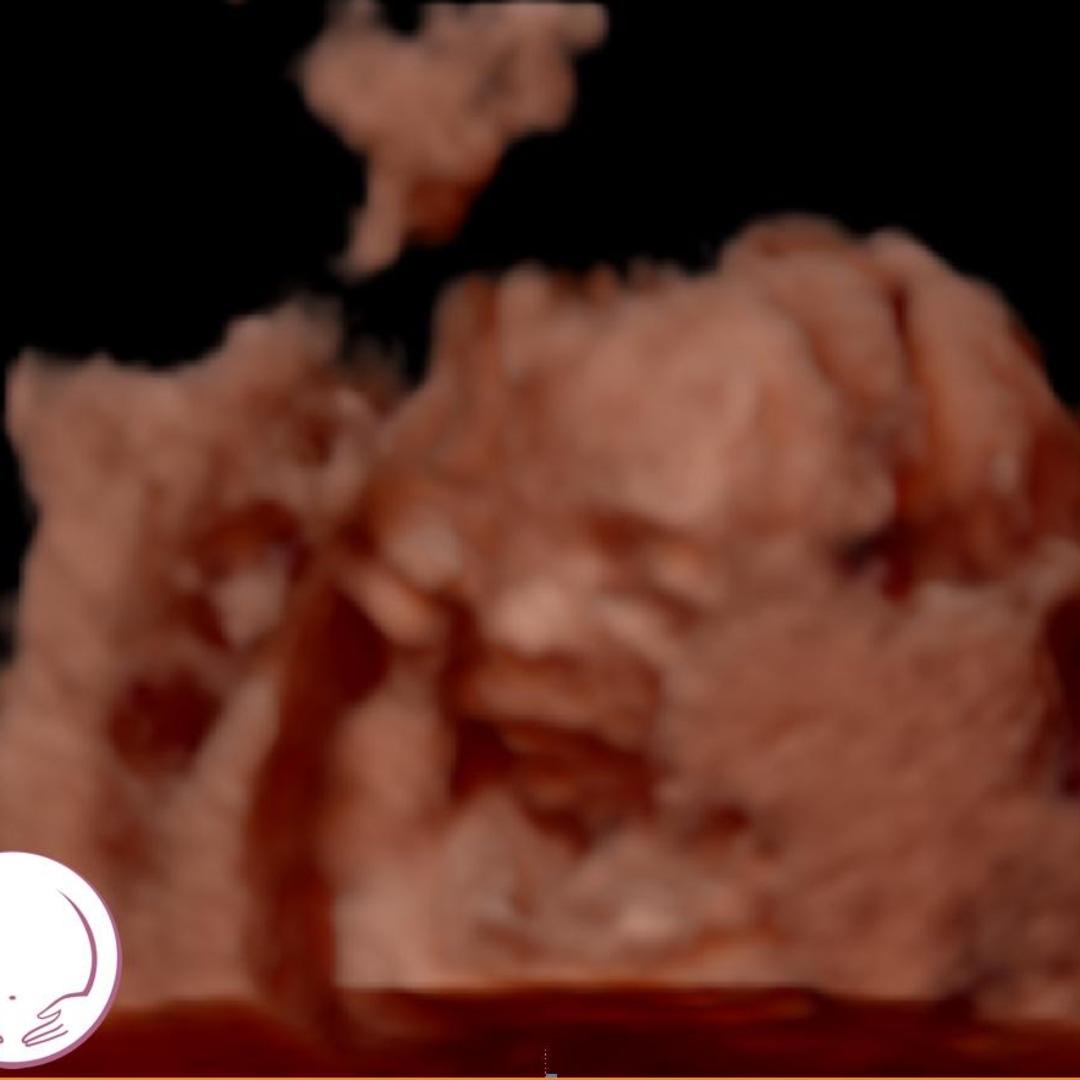 Photo shared by Kylie for their Babylist baby registry.