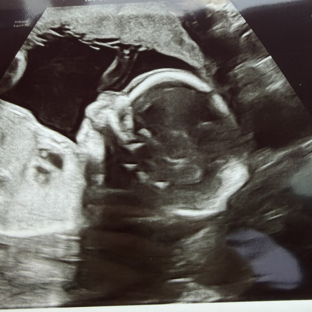 Photo shared by Evelyn for their Babylist baby registry.