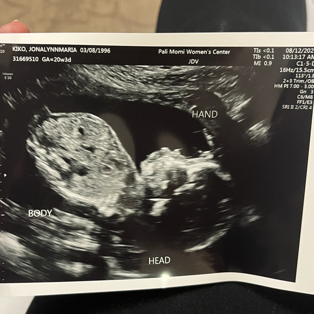 Photo shared by Jonalyn for their Babylist baby registry.