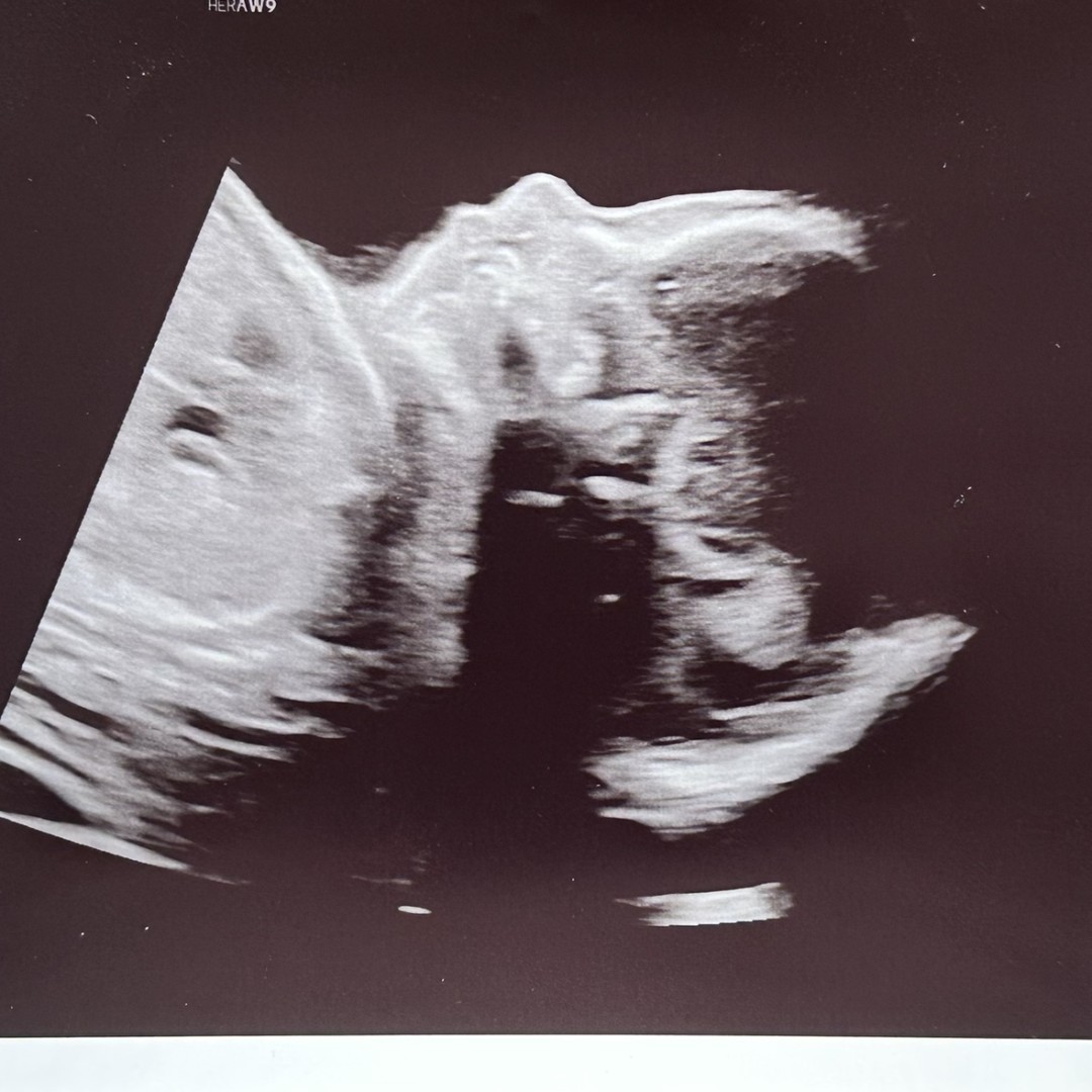 Photo shared by Jenna for their Babylist baby registry.