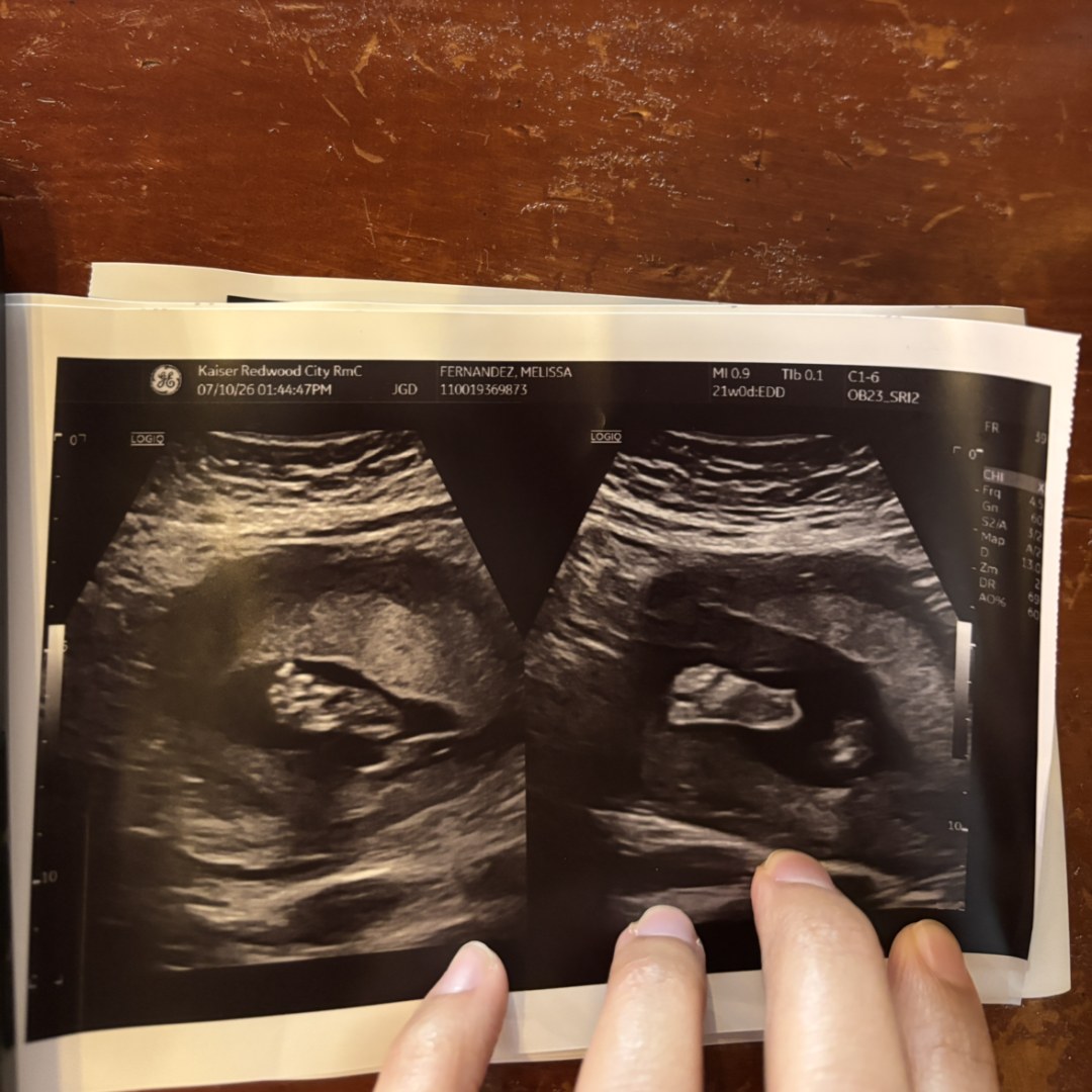 Photo shared by Melissa for their Babylist baby registry.