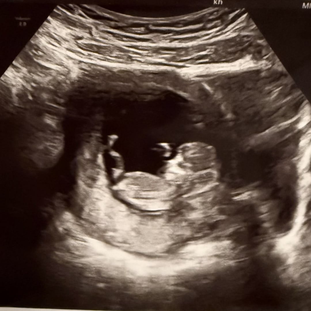 Photo shared by Pritesh for their Babylist baby registry.