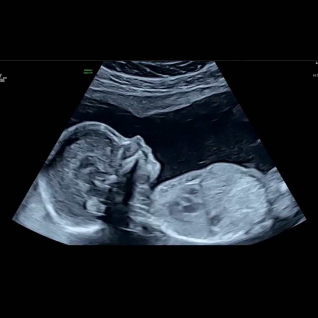 Photo shared by Hailey for their Babylist baby registry.