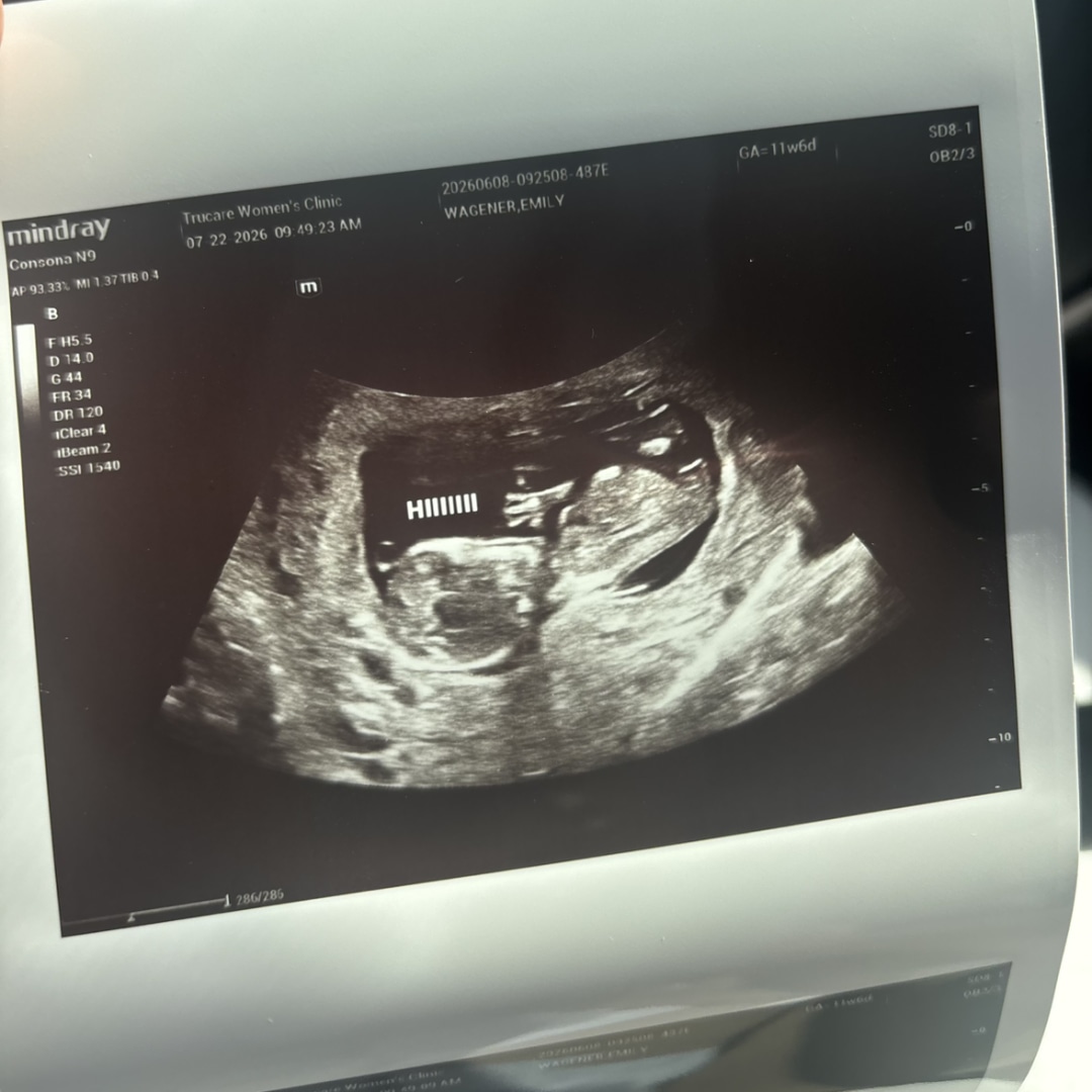 Photo shared by Emily for their Babylist baby registry.