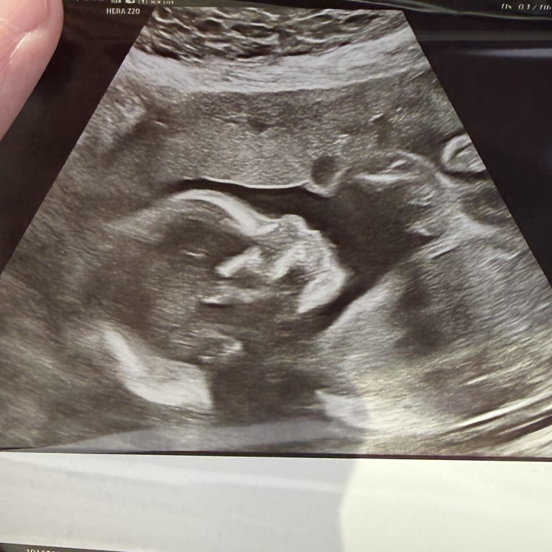 Photo shared by Alexandra for their Babylist baby registry.