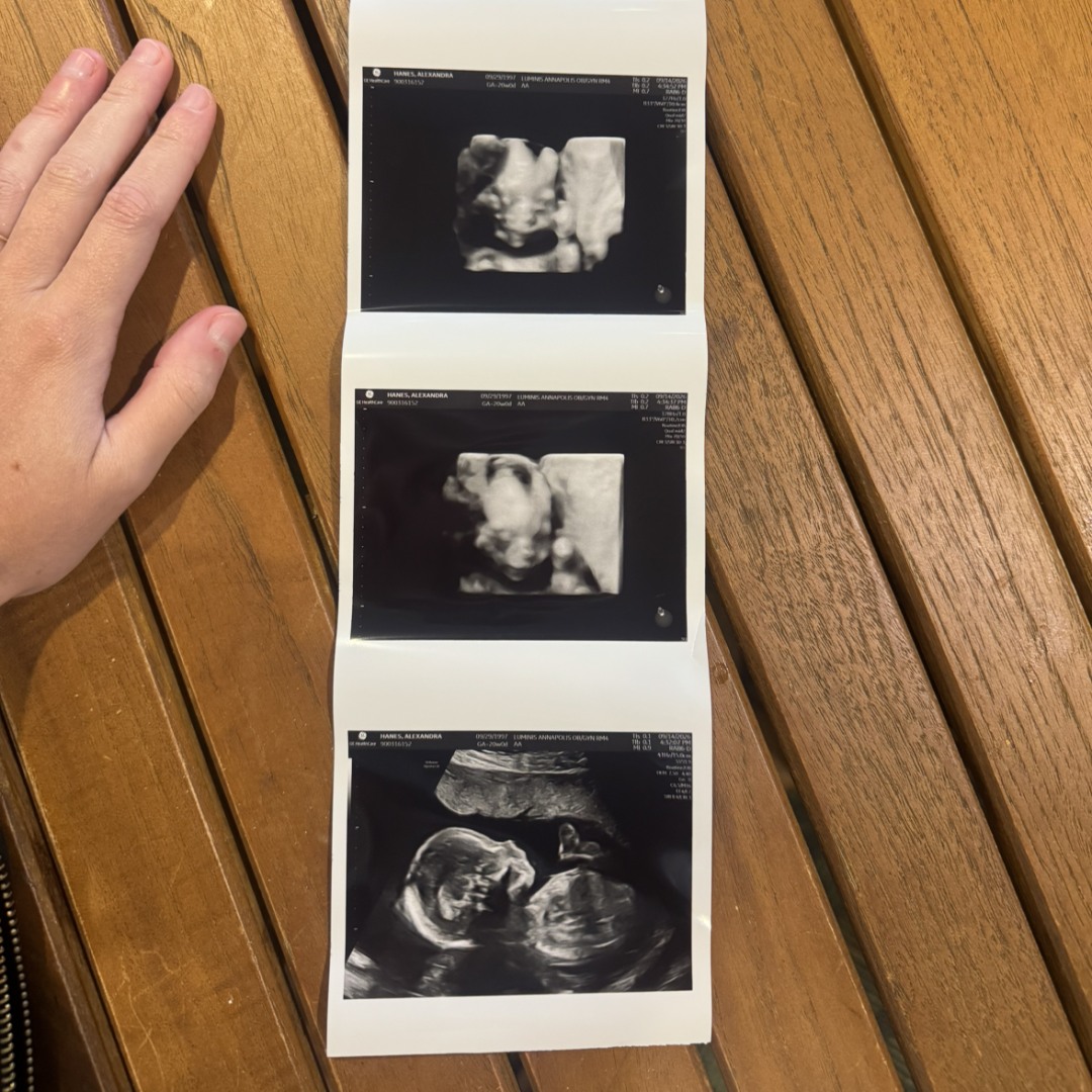 Photo shared by Allie for their Babylist baby registry.