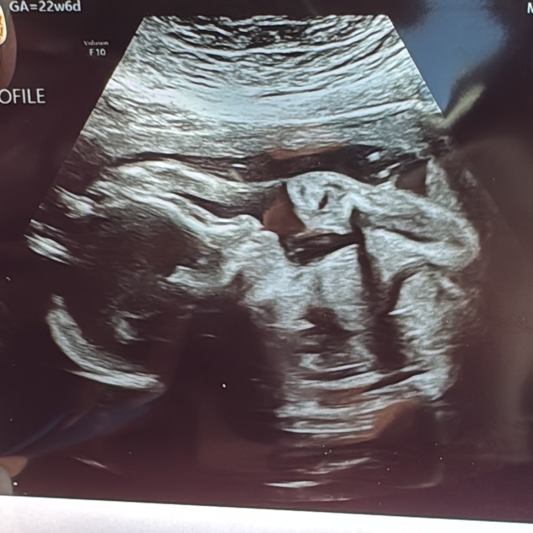 Photo shared by Cynthia for their Babylist baby registry.