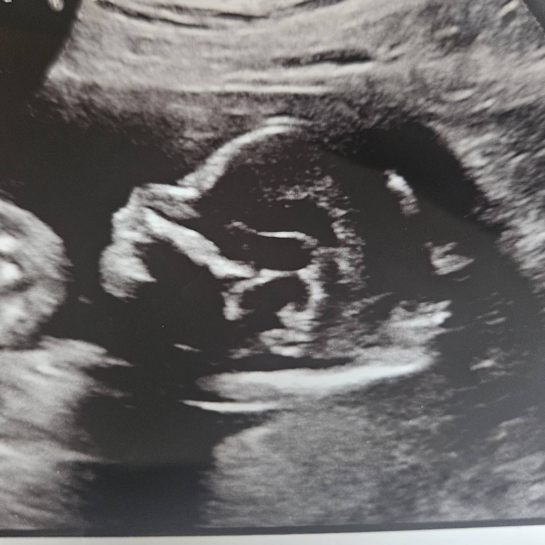 Photo shared by Kate for their Babylist baby registry.