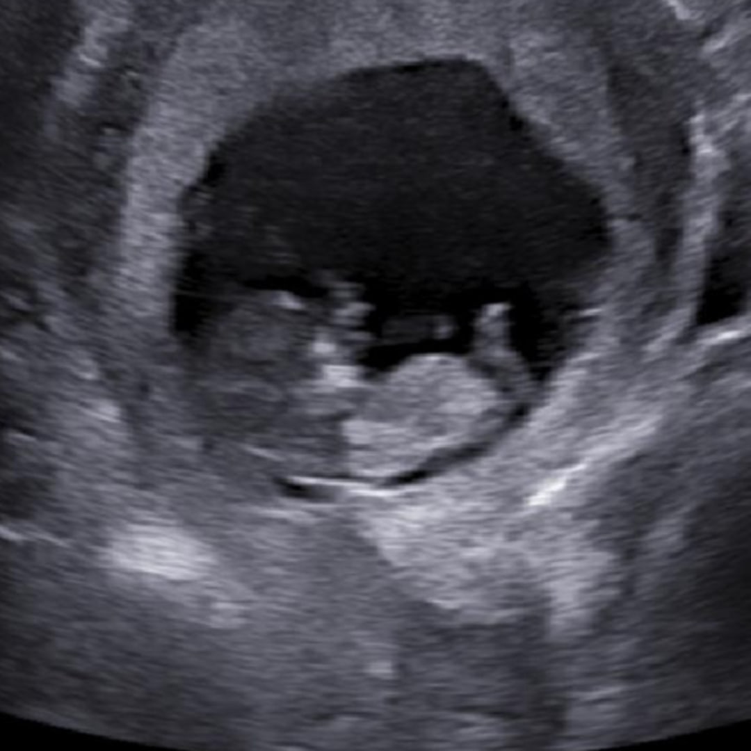 Photo shared by Hayley for their Babylist baby registry.