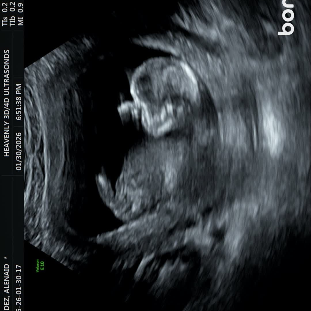 Photo shared by Alenaid for their Babylist baby registry.