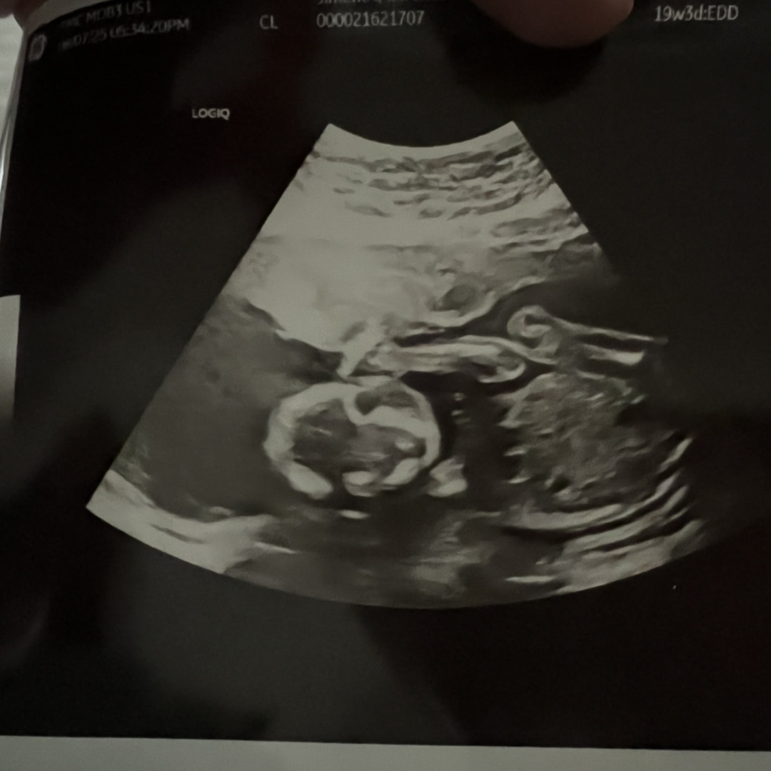 Photo shared by Carolina for their Babylist baby registry.