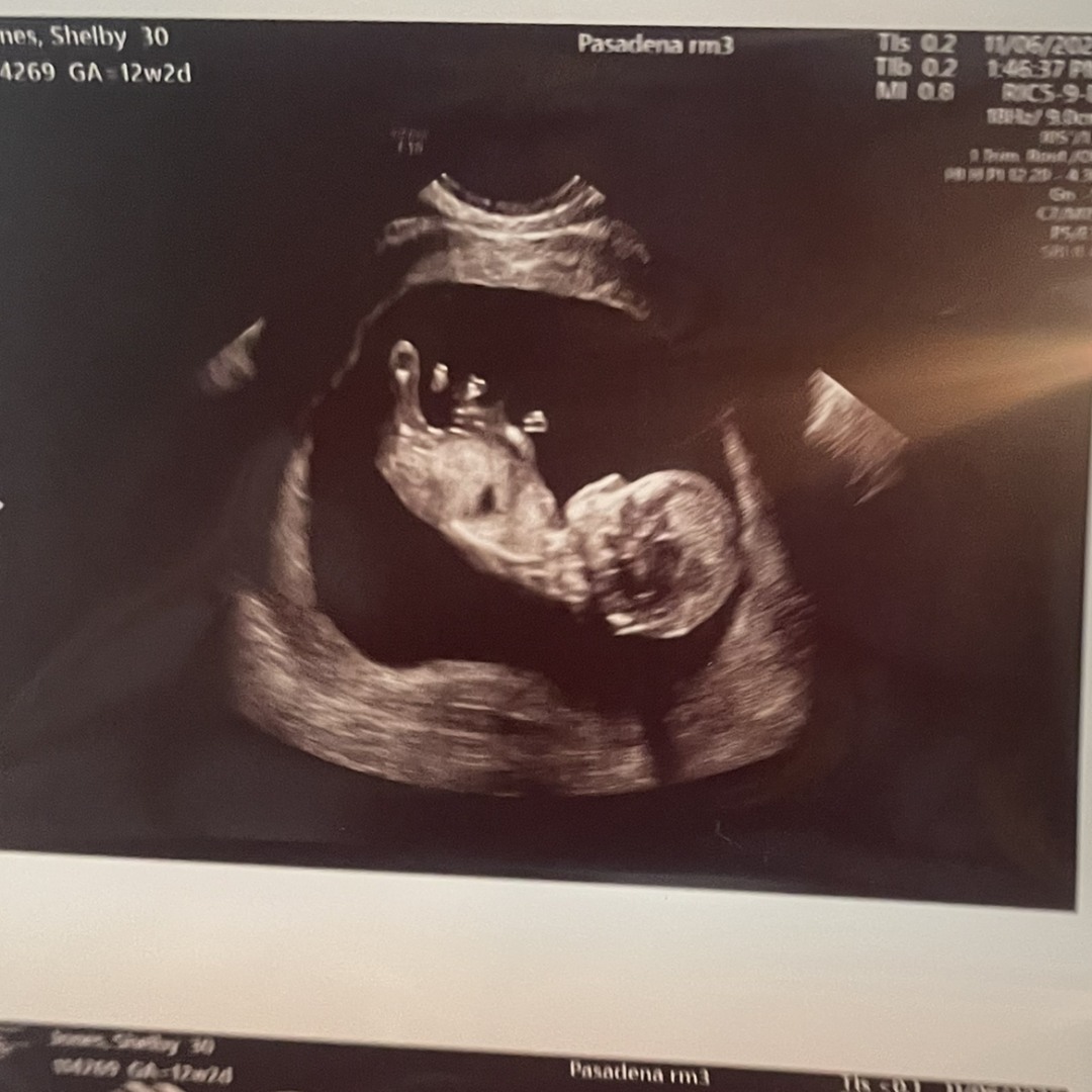 Photo shared by Shelby for their Babylist baby registry.