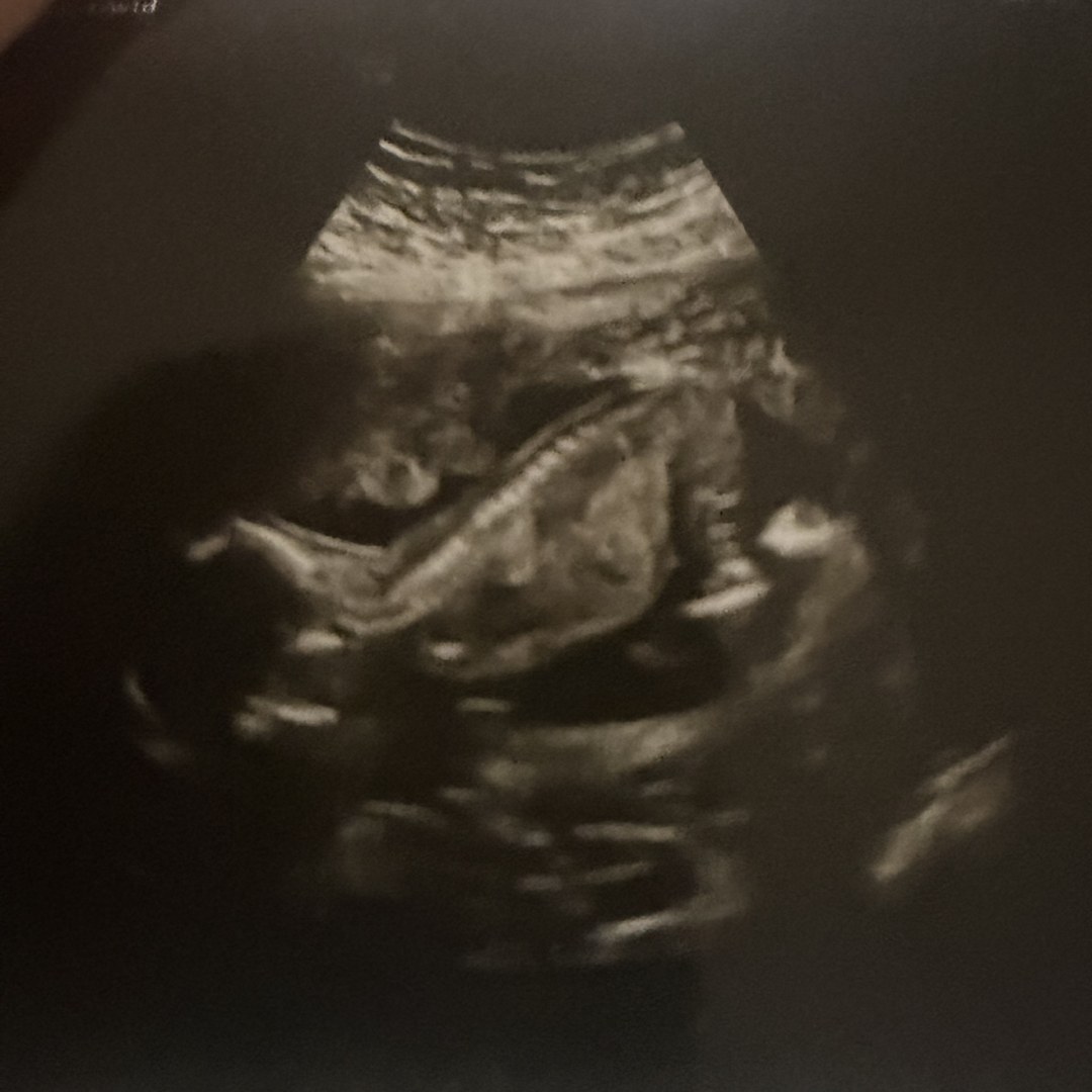 Photo shared by Aliah for their Babylist baby registry.